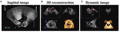 Management and Follow-Up Practices of Women With Recurrent Stress Urinary Incontinence Following Transobturator Mid-urethral Synthetic Sling Procedure: A 6-Year Retrospective Monocentric University-Based Study